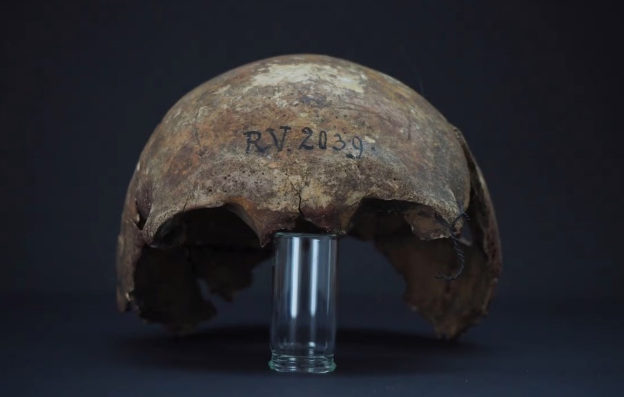 Najstariji poznati soj kuge pronađen je kod čoveka pre 5.000 godina