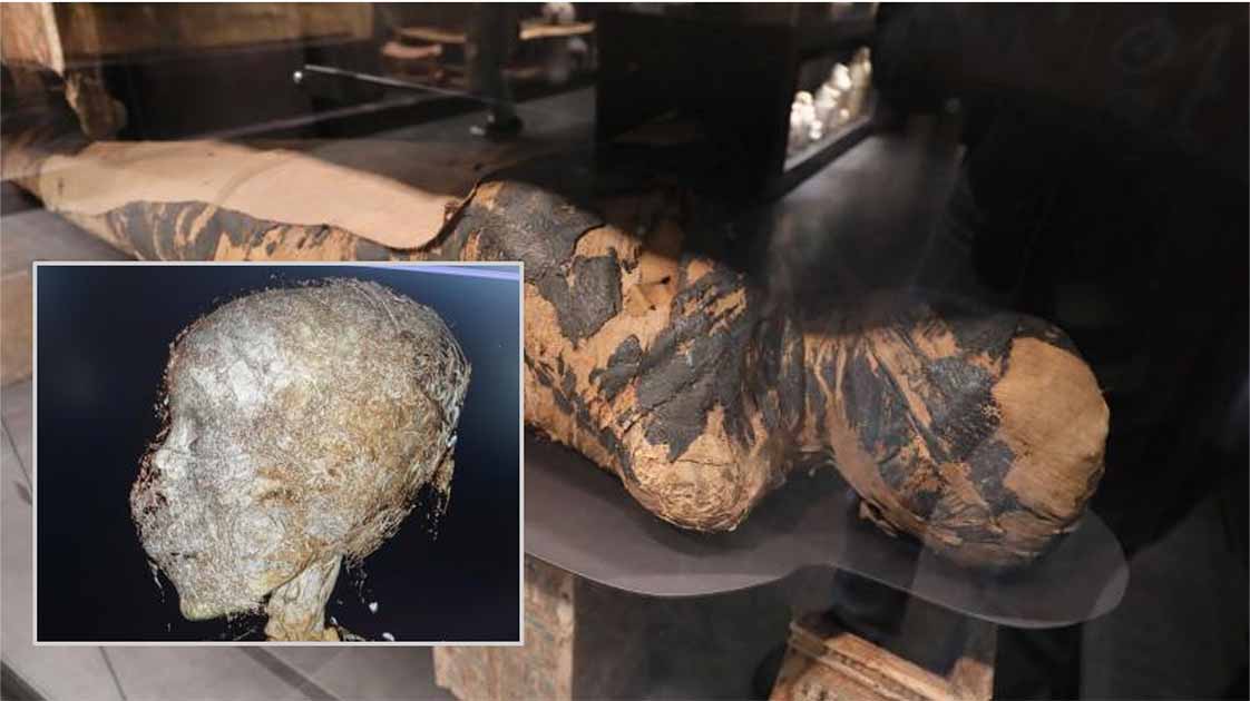 Mogući tragovi raka otkriveni na 2.000 godina staroj egipatskoj mumiji koja je bila trudna
