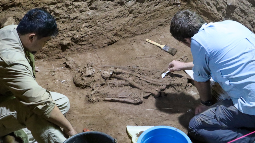 Najstarija amputacija noge na svetu zabeležena je pre 30.000 godina