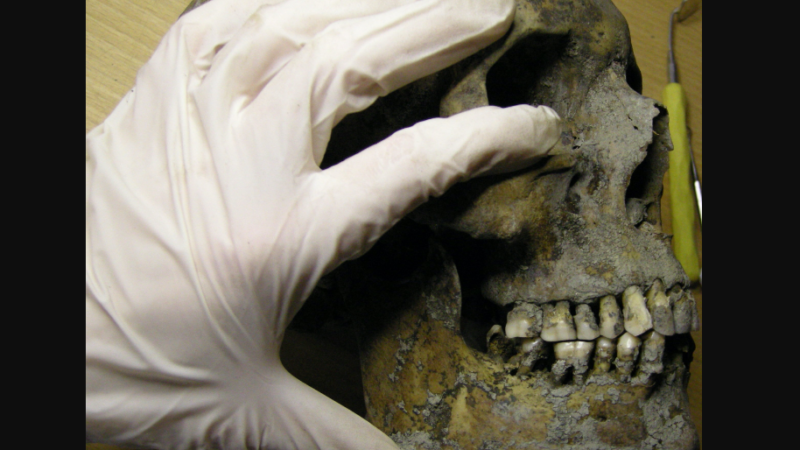 Iznenađujuće saznanje: Vikinzi su imali naprednu stomatologiju