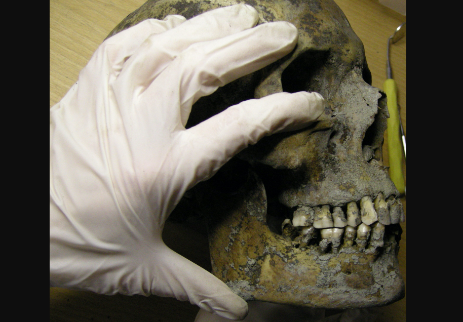 Iznenađujuće saznanje: Vikinzi su imali naprednu stomatologiju