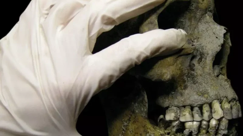 Iznenađujuće saznanje: Vikinzi su imali naprednu stomatologiju