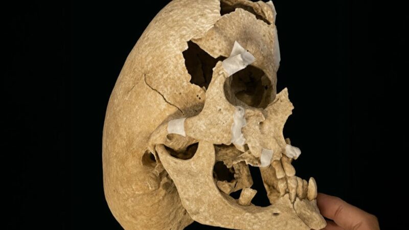 Pronađen vitez sa retkim genetskim oboljenjem koji je poginuo u borbi