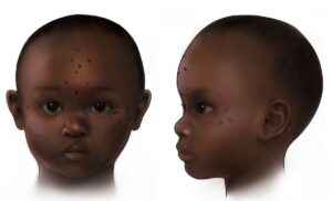 Tetovirano lice deteta (7-9. vek)