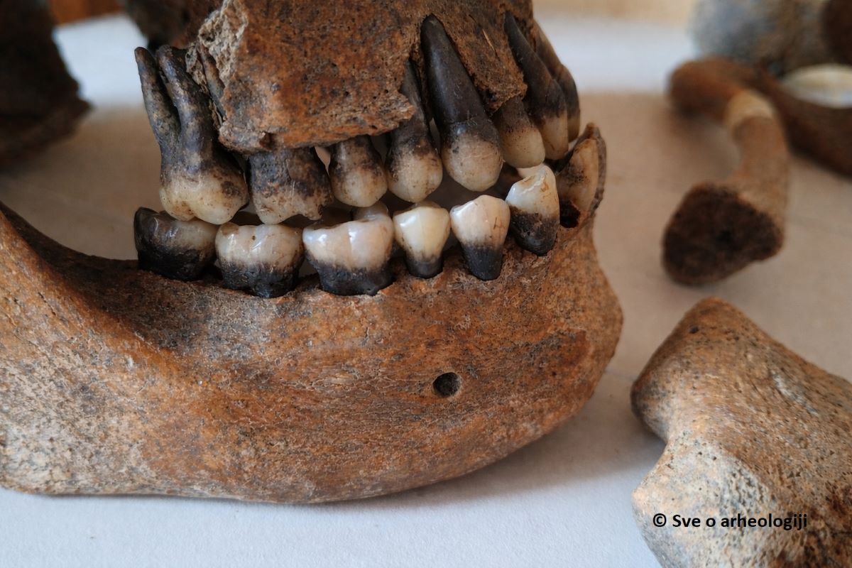 Kraljevstvo crnih zuba: zašto su drevni ljudi bojili zube u crno pre 2.000 godina?