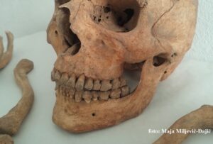 Lobanja, antropološka analiza