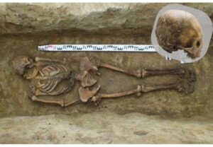 Grob žene sa veštačkom deformacijom lobanje